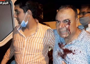 الاتحاديون يتهمون محسوبين على “البام” بالإعتداء على أحد قيادييهم بضواحي الجديدة