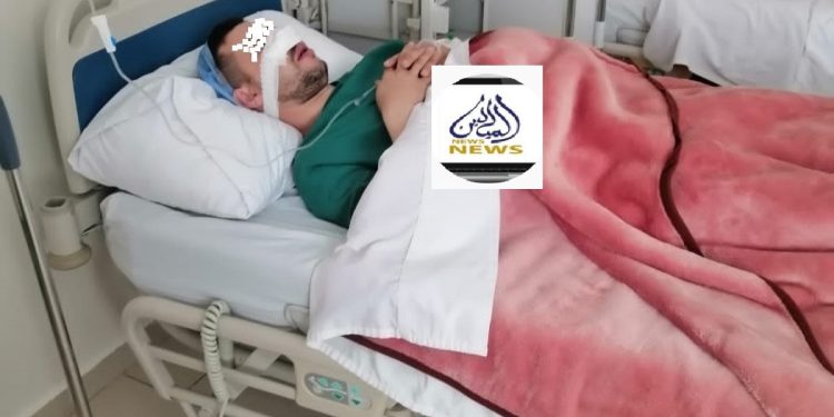 أحد ضحايا العصابة الخطيرة بفاس