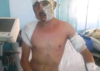 تالسينت(إقليم فكيك).. زوجة تحرق زوجها بالزيت المغلي((+ فيديو))
