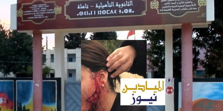 الصورة مركبة ..ثانوية تاهلة التأهيلية